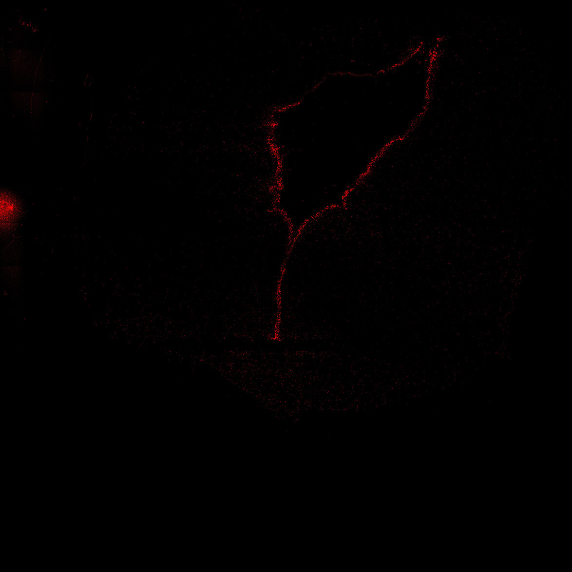 Human foetal midbrain